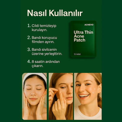 Acnevo Akne Bandı 15'li Sivilce / Akne Bandı